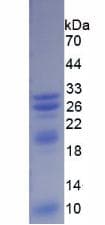 Human TREM1 Protein (Recombinant His, N-Terminal)