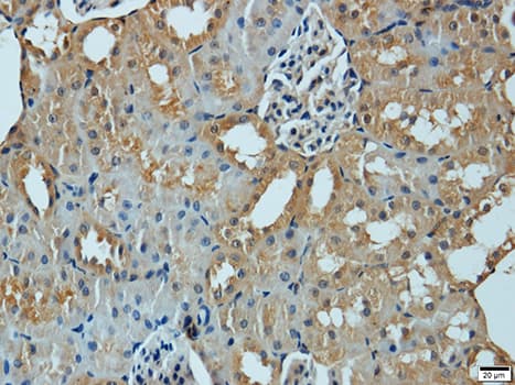 Polyclonal Rabbit anti-Human MMP1 Antibody (IHC, WB)