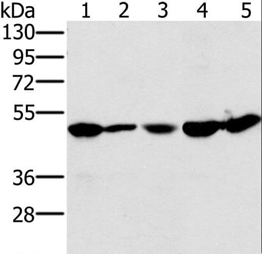 Polyclonal Rabbit anti-Human PSMC2 / RPT1 Antibody (IHC, WB)