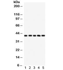 HLA-C Antibody