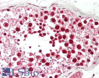 IHC-plus™ DDX1 Antibody (aa650-C-term)