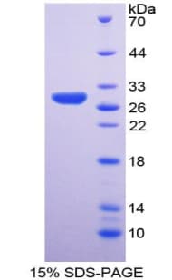 Human RPP40 / Ribonuclease P Protein (Recombinant His-T7)