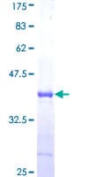 Human CEB1 / HERC5 Protein (Recombinant GST, N-terminus)