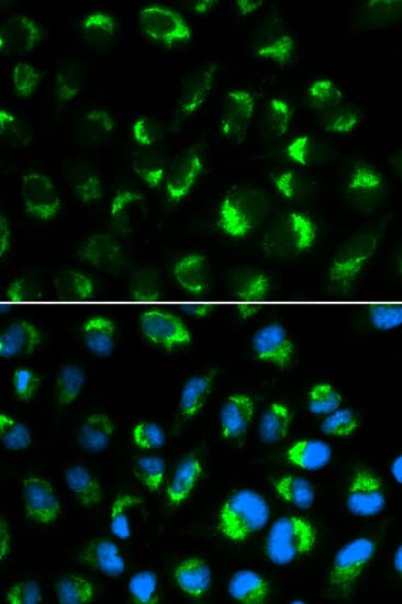 IHC-plus™ SHMT / SHMT2 Antibody