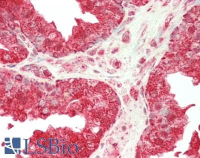 IHC-plus™ HK1 / Hexokinase 1 Antibody (aa13-475)