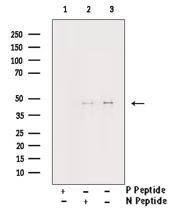 Polyclonal Rabbit anti-Human CHEK1 / CHK1 Antibody (phospho-Ser296, IHC, IF, WB)