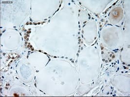 Monoclonal Mouse anti-Human GAD1 / GAD67 Antibody (clone OTI3G9, IHC, WB)