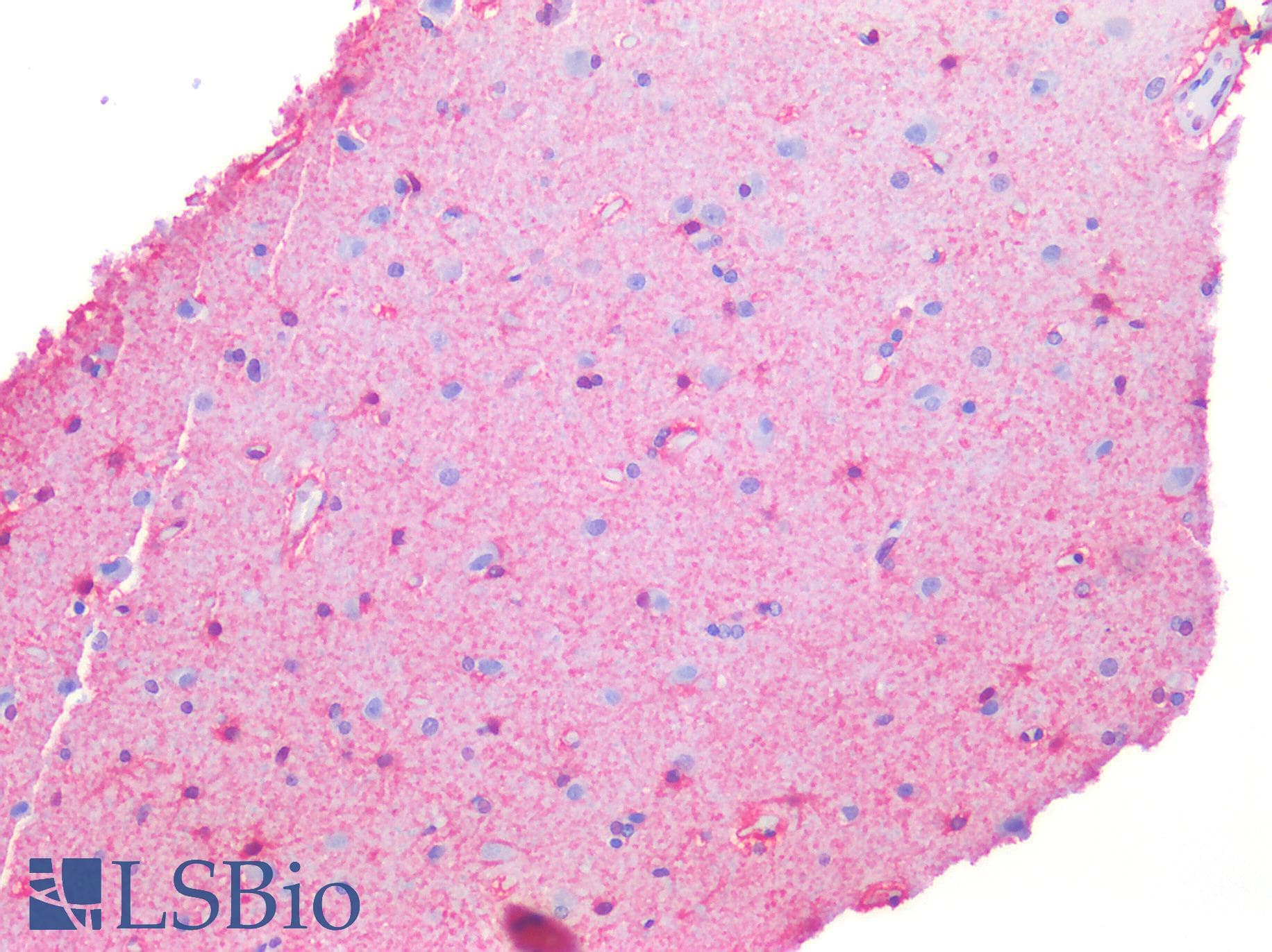 IHC-plus™ NET1 / ARHGEF8 Antibody