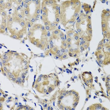 Polyclonal Rabbit anti-Human MRPS22 Antibody (IHC, WB)