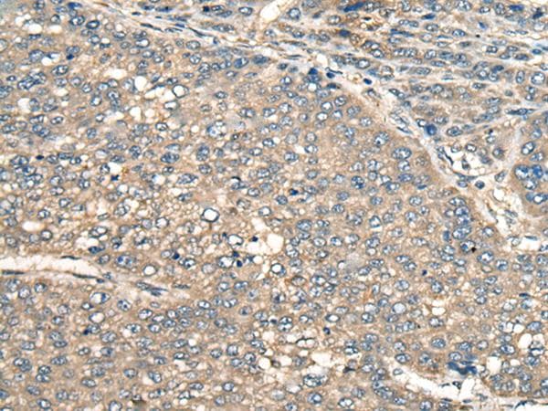 PIAS3 Antibody