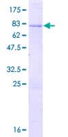 Human RBM41 Protein (Recombinant GST)