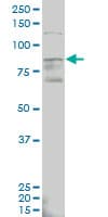 Monoclonal Mouse anti-Human ALDH18A1 Antibody (clone 2B5, WB)