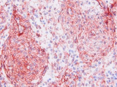 Reticular Fibroblasts and Reticular Fibers Antibody (clone PRF414)