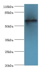 TPTE Antibody (aa175-380, FITC)