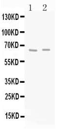 Polyclonal Rabbit anti-Human GAD65 Antibody (IHC, WB)