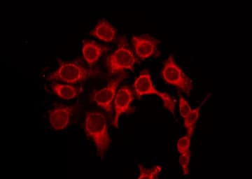 PRKACA Antibody