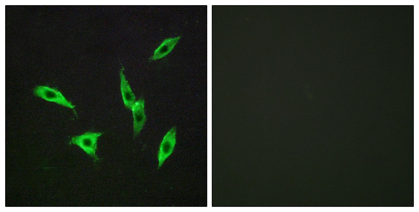 ADORA2B/Adenosine A2B Receptor Antibody