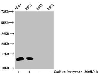 HIST1H2BN Antibody