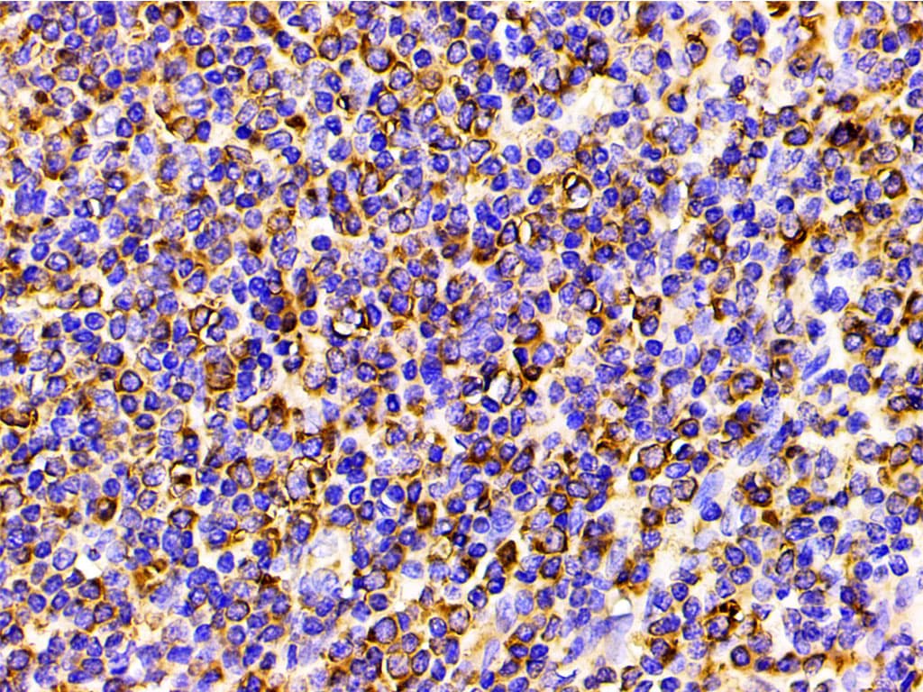 PIK3R1 / p85 Alpha Antibody (phospho-Tyr607)
