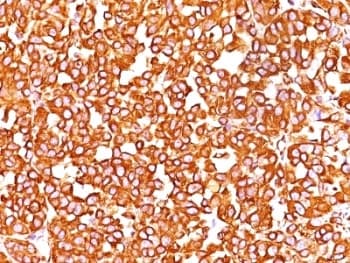 Vimentin Antibody (clone SPM576)