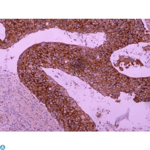 EGFR Antibody