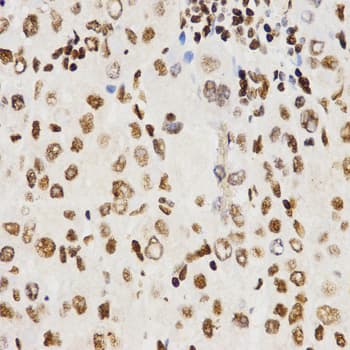 Polyclonal Rabbit anti-Human Histone H3 Antibody (IHC, IF, WB)