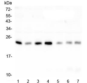 RAB11B Antibody