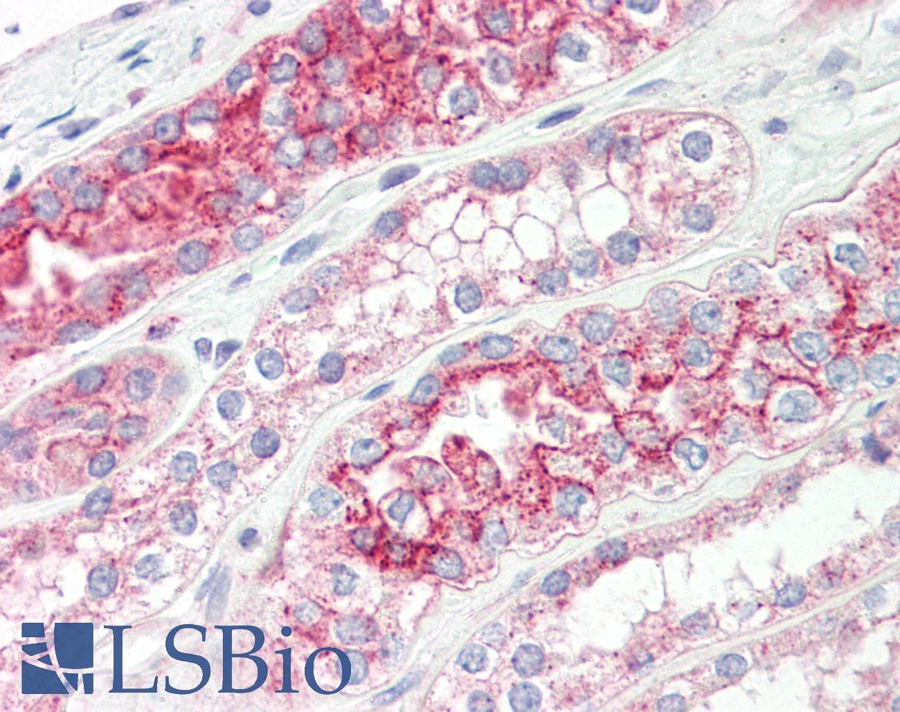 IHC-plus™ Polyclonal Rabbit anti-Human TMPRSS3 Antibody (aa405-454, IHC, IF, WB)