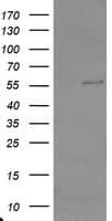 TRAIP / TRIP Antibody (aa67-313, clone OTI2D4, Carrier-free)