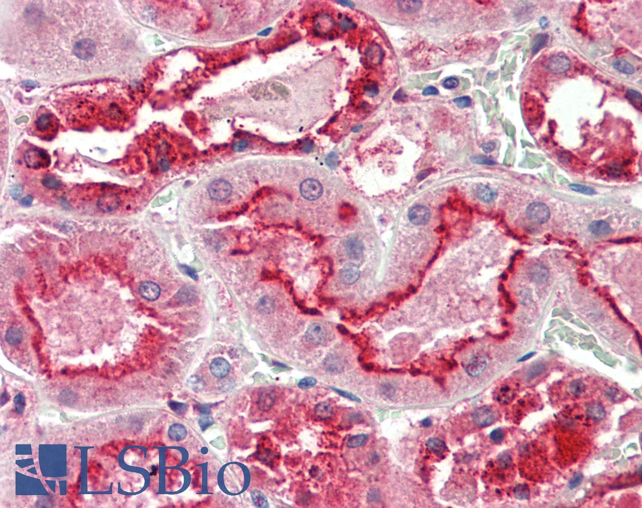 IHC-plus™ GGCX Antibody (aa746-757)