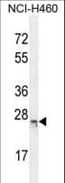 Polyclonal Rabbit anti-Human C16orf45 Antibody (aa86-115, IHC, WB)