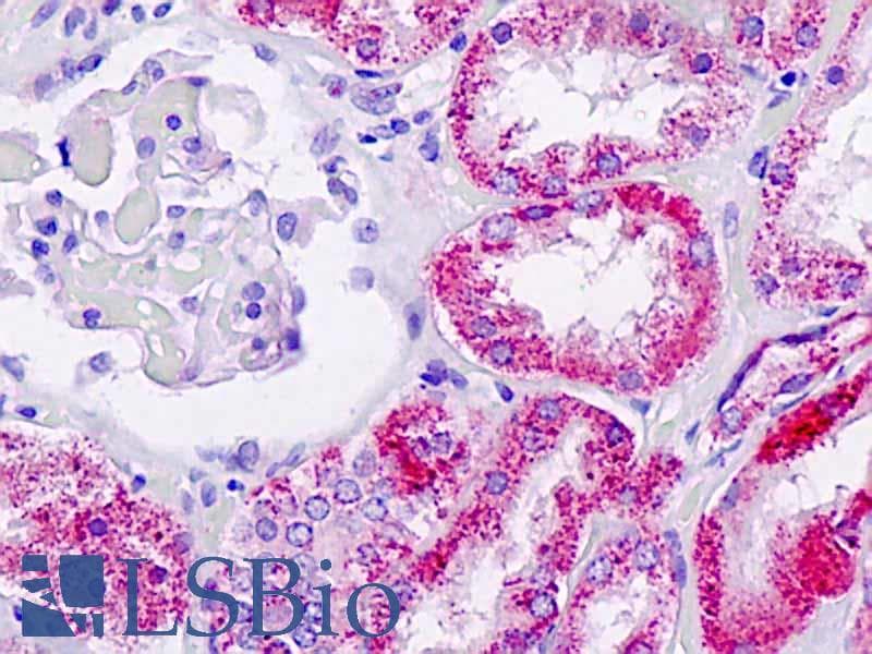 IHC-plus™ Polyclonal Rabbit anti-Human Alpha Fucosidase / FUCA1 Antibody (aa265-294, IHC, WB)