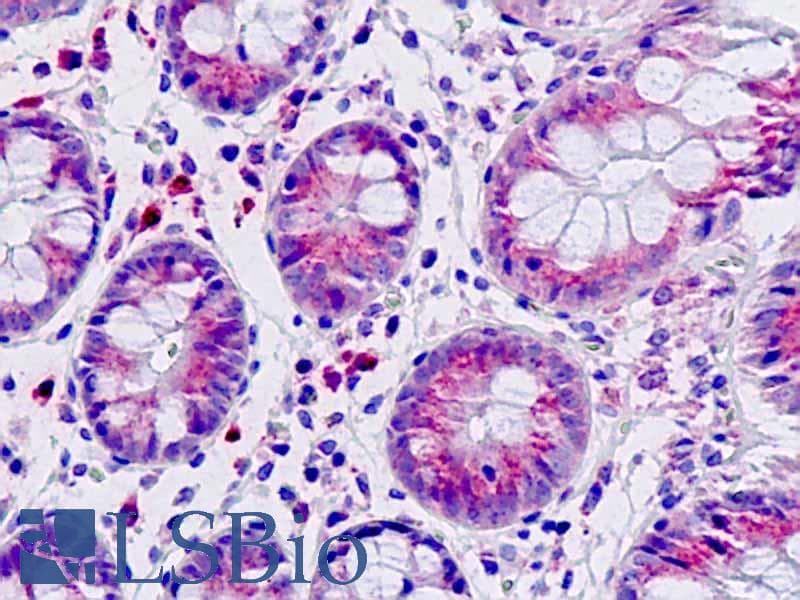 IHC-plus™ Polyclonal Rabbit anti-Human DAB1 Antibody (aa199-248, IHC, IF, WB)