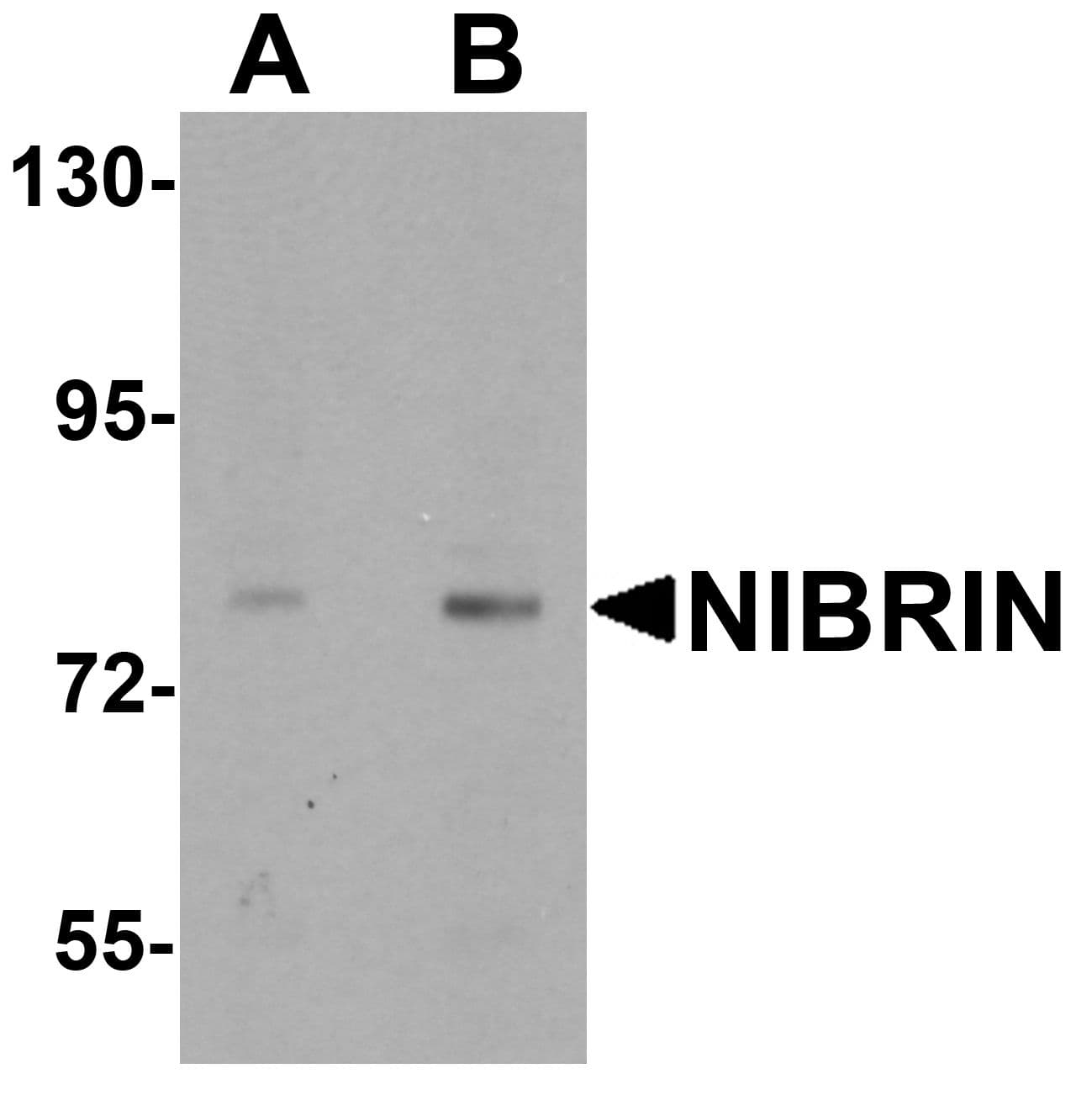 Polyclonal Rabbit anti-Human NBN / Nibrin Antibody (IHC, IF, WB)