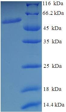 Human MON1A / SAND1 Protein (Recombinant His-SUMO)