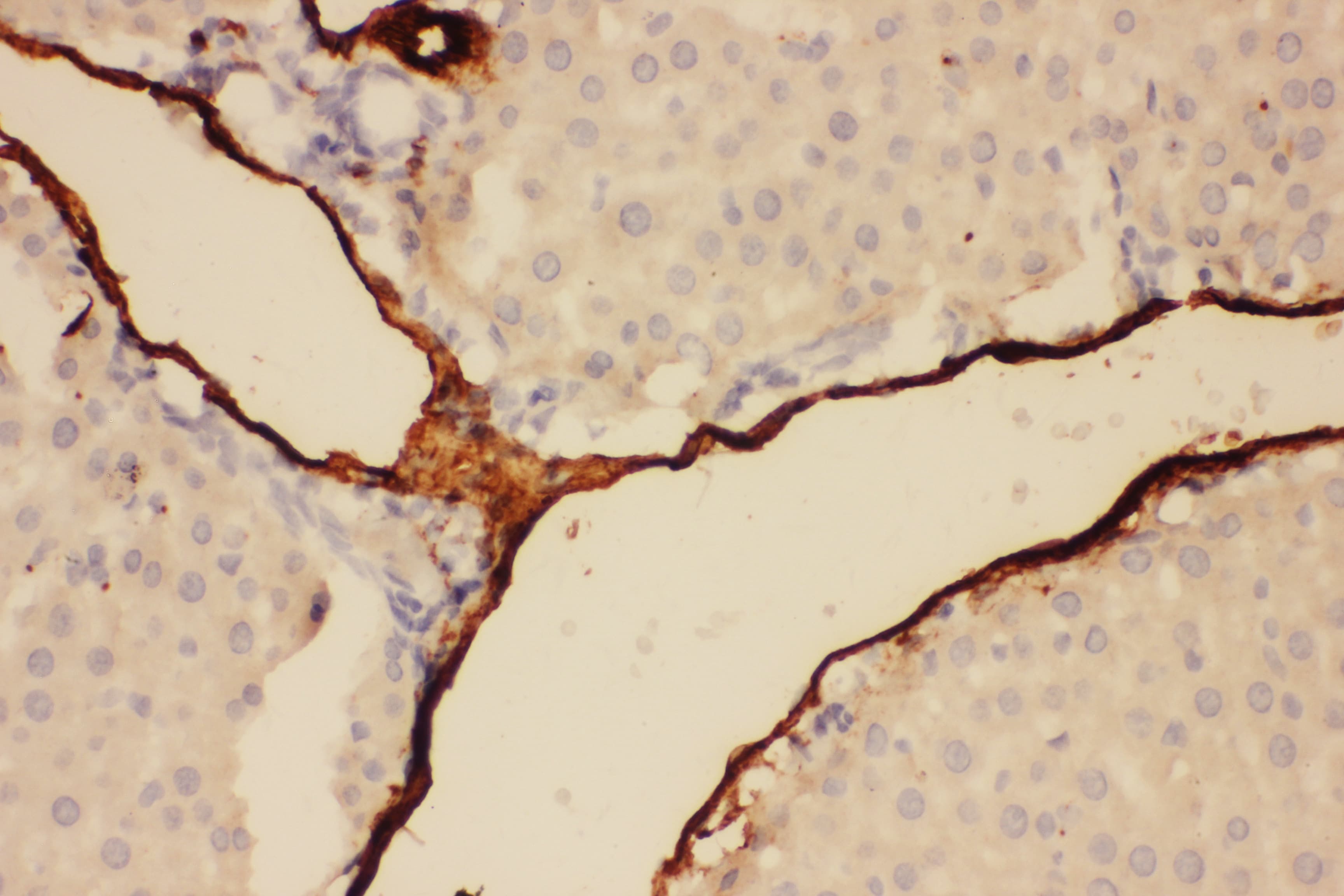 Polyclonal Rabbit anti-Rat Adiponectin Antibody (aa19-244, IHC, WB)