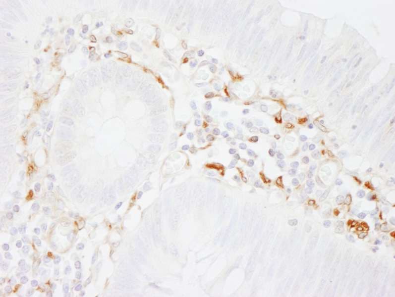 FLNA / Filamin A Antibody (aa1725-1775)