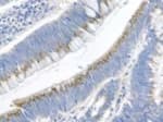 Polyclonal Rabbit anti-Human GREM1 / Gremlin-1 Antibody (IHC)
