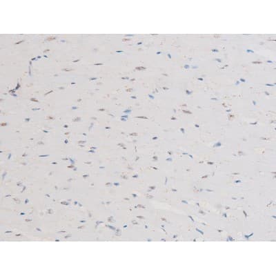 RELA / NFKB p65 Antibody (phospho-Ser281)