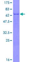 Human GOT2 Protein (Recombinant GST)