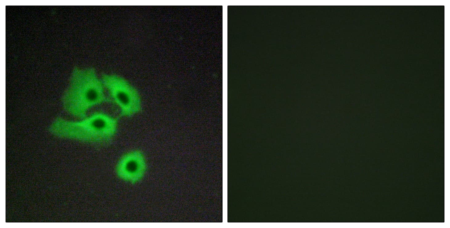 IHC-plus™ ACKR2 / CCR10 / D6 Antibody (aa335-384)