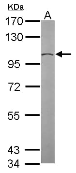 Polyclonal Rabbit anti-Human TUBGCP2 / GCP2 Antibody (aa1-226, IHC, WB)