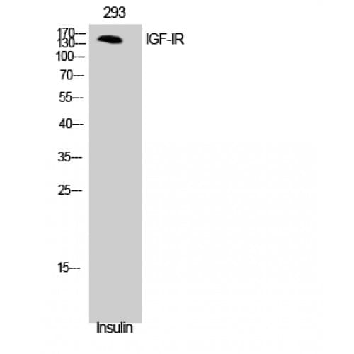 Polyclonal Rabbit anti-Human IGF1R / IGF1 Receptor Antibody (1100-1180 aa, WB)