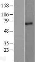 Human PIAS2 / PIASX Protein (Over-Expression Lysate Myc-DDK (Flag))