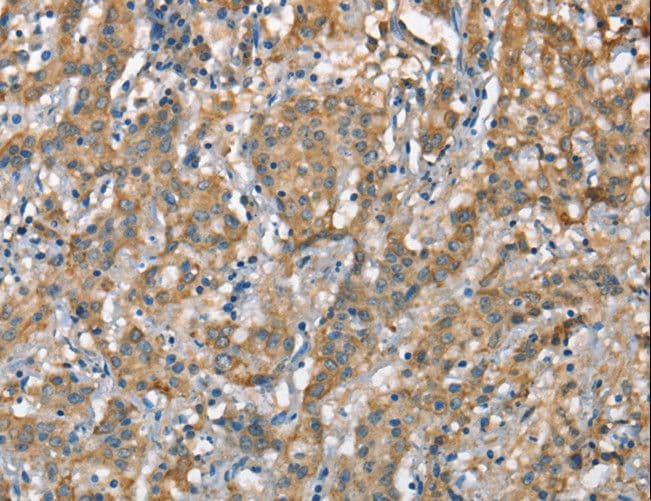 Polyclonal Rabbit anti-Human CSMD1 Antibody (IHC)