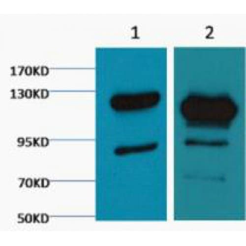 PARP1 Antibody (clone M4)