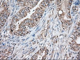GORASP1 / GRASP65 Antibody (clone OTI5C5)