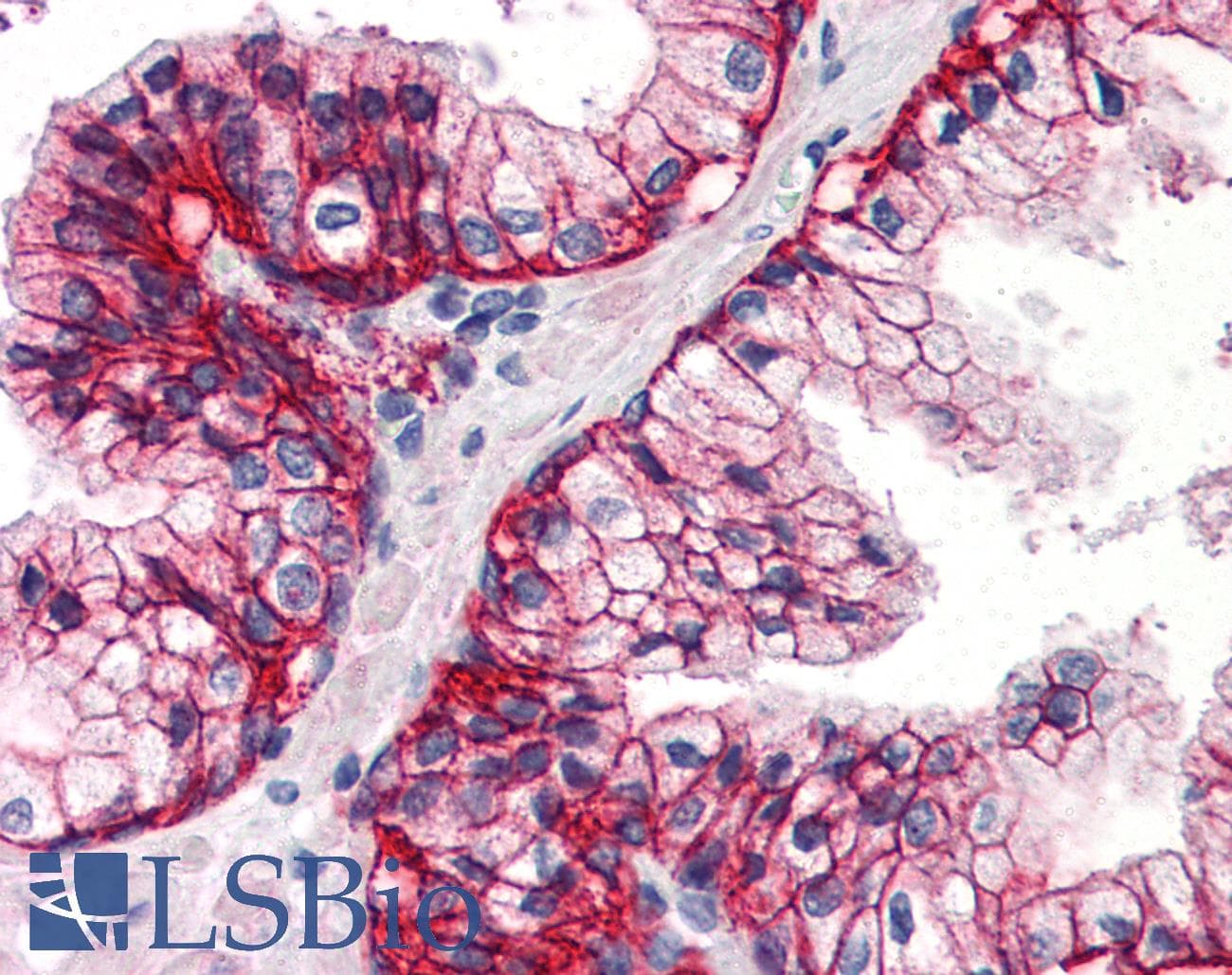 IHC-plus™ Polyclonal Rabbit anti-Human SLC1A5 / ASCT2 Antibody (C-Terminus, IHC)