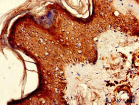 KIR2DS2 / CD158j Antibody