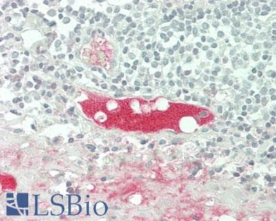 IHC-plus™ Polyclonal Rabbit anti-Human CST1 / Cystatin SN Antibody (Internal, IHC, IF, WB)